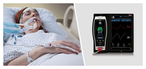 Masimo Root® with PVi® and SpHb®