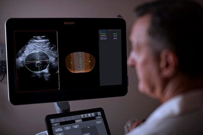 Philips, 3d Ultrasound, Abdominal Aortic Aneurysm