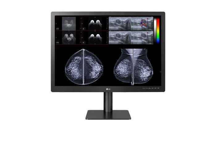 LG, Expands Diagnostic Medical Monitor Line with New 12-Megapixel Multimodality Display
