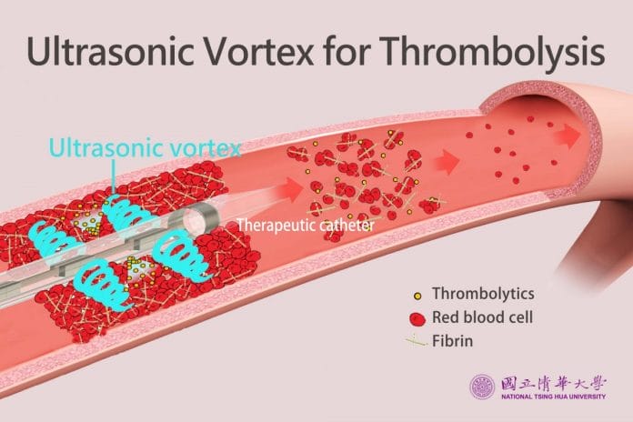 NTHU Researchers Develop Ultrasonic Vortex Thrombolytic Device