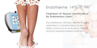 Next-Gen LUMESEAL Laser for Treatment of Varicose Vein Receives CE Approval