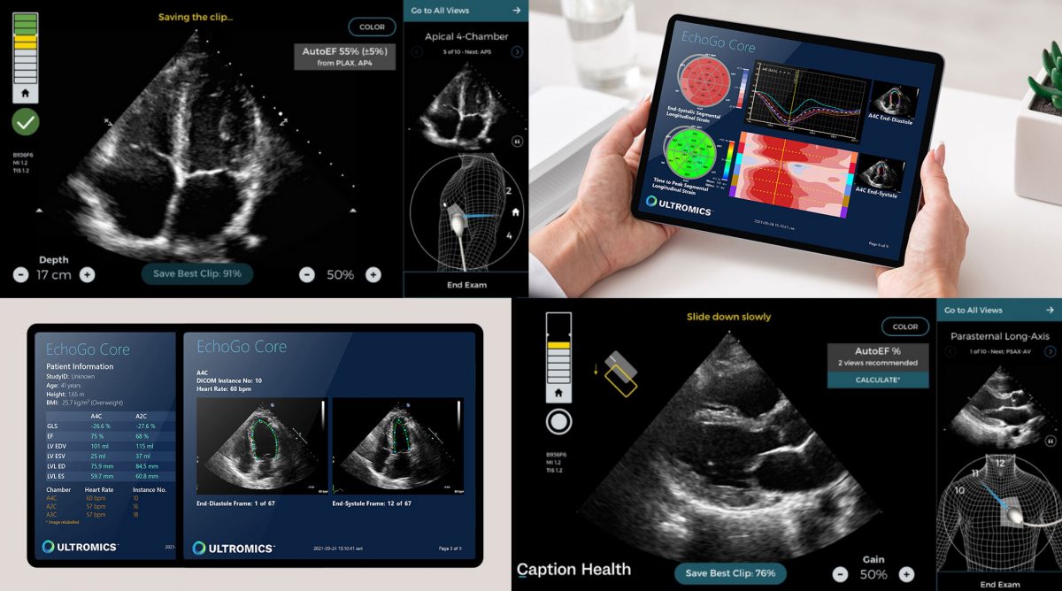 Caption Health and Ultromics Partner to Put Heart Disease Detection and Management Tools in More Hands news reported by Medical Device News Magazine