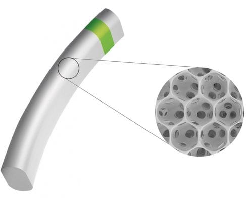 News Final Results from the STAR-II European Trial for MINIject in Glaucoma Patients Reported at AAO reported by Medical Device News Magazine