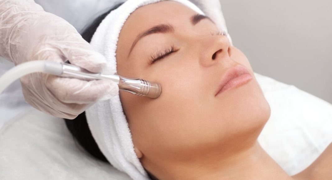 How Microdermabrasion Can Improve Your Skin