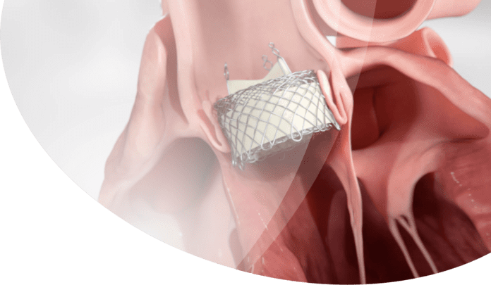 HLT Gains FDA Approval for Two TAVR Clinical Studies