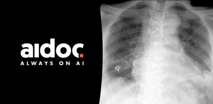 Aidoc Expands AI Service to X-ray, Receiving FDA 510(k) Clearance for Pneumothorax