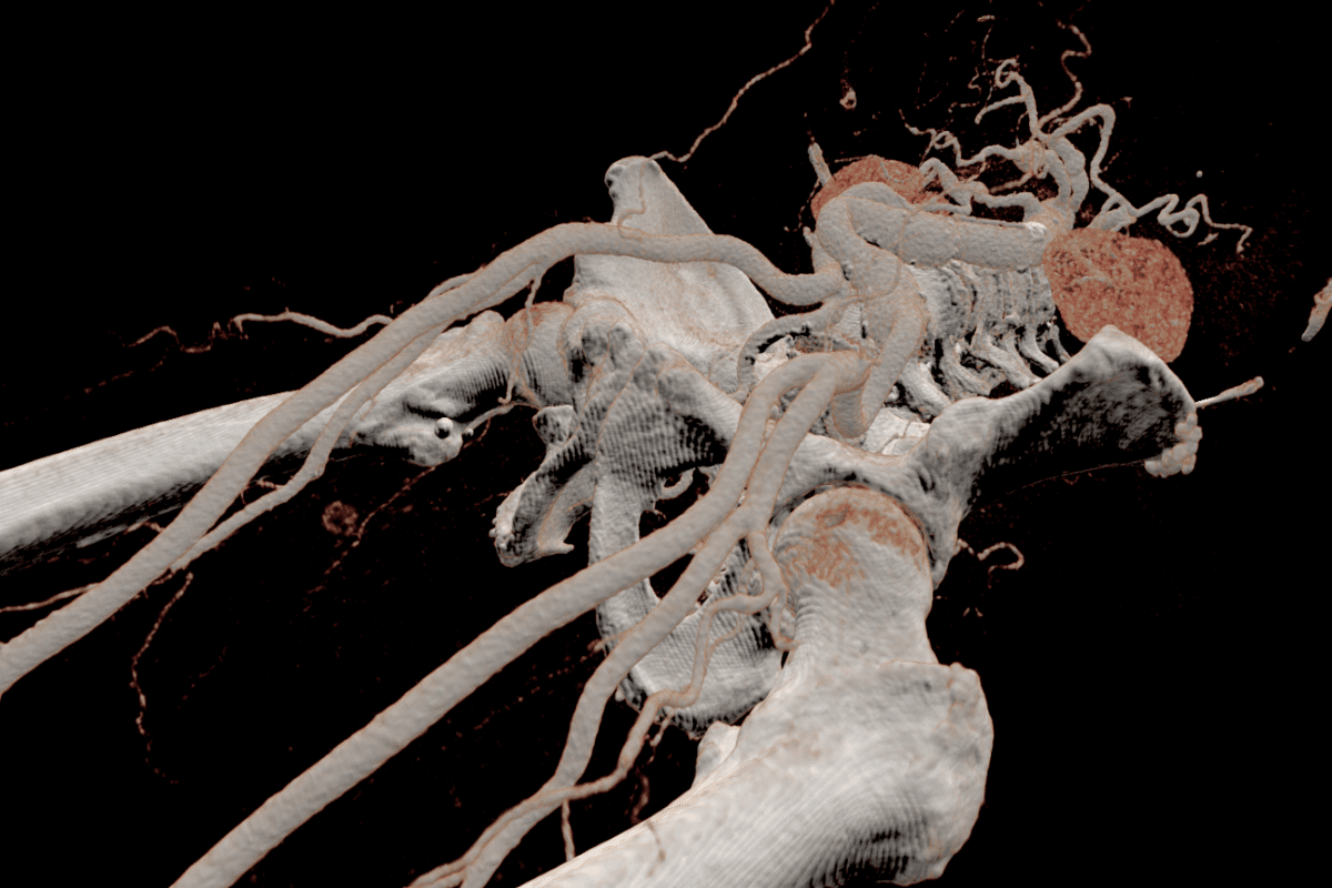 Image Vr Cardiovascular Avatar Medical Visualization Of Vascular Ct Scan