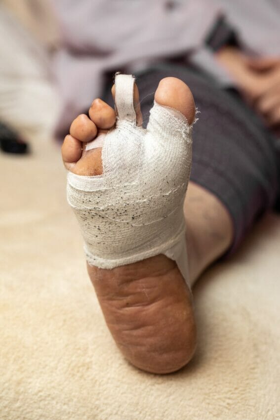 When Is Corrective Foot Surgery Necessary?