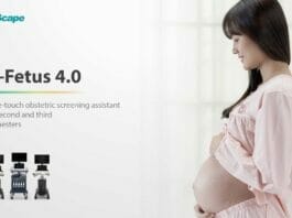 SonoScape Medical S-Fetus 4.0 Release to Simplify Sonography Process