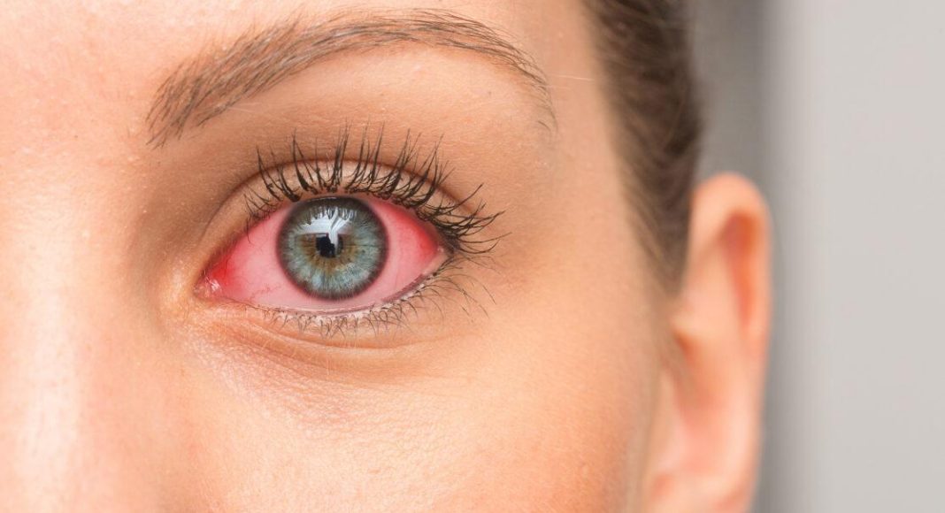 8 Common Causes Of Skin Irritation Around The Eyes: read this article to learn more.