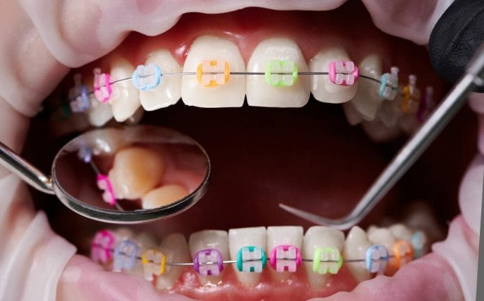 How To Choose The Right Orthodontic Treatment