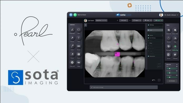 SOTA’s Dental Imaging Software Gets Pearl’s AI Pathology Detection Capabilities