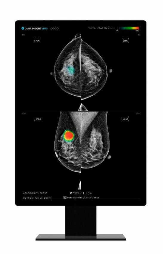 Lunit and Agfa HealthCare Bring Breast Imaging AI Solution to Dubai Academic Health Corporation Dubai Hospital