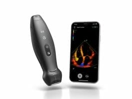 Mindray Revolutionizes the Way of Using Ultrasound with TE Air, Its First Wireless Handheld Ultrasound System