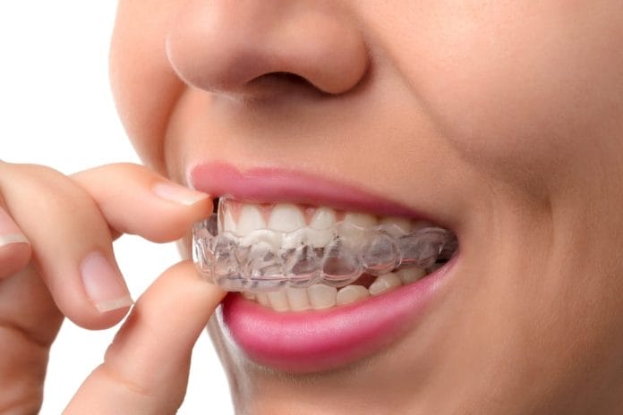 Alternatives to Traditional Braces