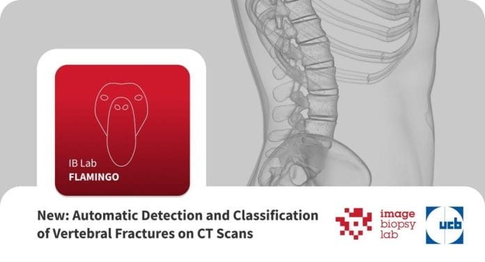 Osteoporotic Fractures of the Spine in CT Scans